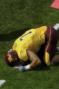Concussions