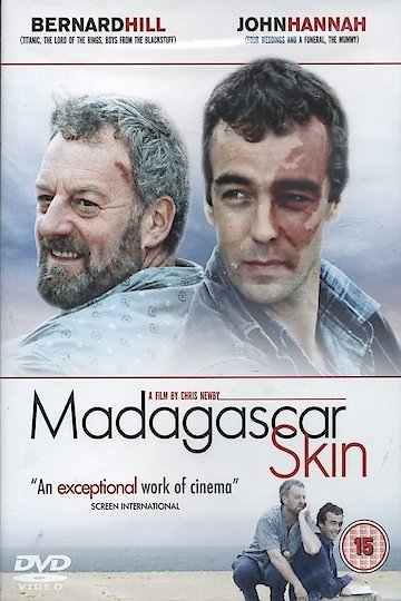 Madagascar Skin Madagascar Skin