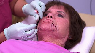 Dr. Pimple Popper Season 1 Episode 4 Dr. Pimple Popper Season 1 Episode 4