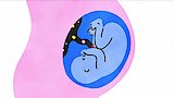 Childbirth