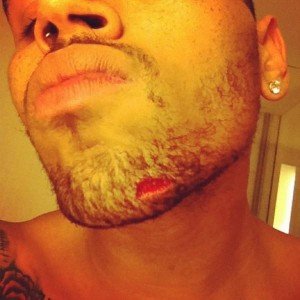 Chris Brown Drake Fight Gash