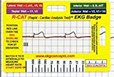 R-CAT EKG Badge Card – Accurately Interpret ECG / EKG Rhythm Strips and 12 Lead EKG Without EKG Calipers – Reader is a Handy Badge Buddy for Nursing – Plus for Paramedic EMS Tool Box and Doctors