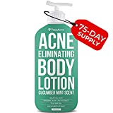 TreeActiv Acne Eliminating Body Lotion - Cucumber Mint Scent, 2% Salicylic Acid Moisturizer Lotion - Body Acne Treatment And Butt Acne Clearing Treatment for Women and Men, Non-GMO