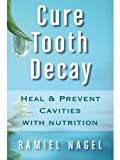Cure Tooth Decay: Heal And Prevent Cavities With Nutrition - Limit And Avoid Dental Surgery and Fluoride [Second Edition] 5 Stars