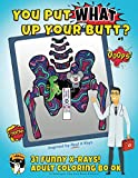 You Put What Up Your Butt? Funny Adult Coloring Book for Radiologists, X-Ray Techs, Nurses & Doctors (Funny X-Rays)