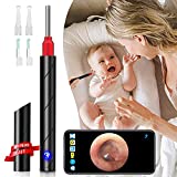 JOYGIFT Ear Wax Remover,Wireless Otoscope Earwax Removal Tool 1080P HD WiFi Ear Endoscope with LED Light,3.5mm Visual Ear Scope Camera Safe Ear Pick Ear Cleaning Endocsope Kit for Adults Kids & Pets