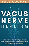 Vagus Nerve Healing: Easy and Inexpensive Vagus Nerve Stimulating Exercises That Activate Your Body’s Natural Self-Healing Power