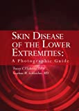 Skin Disease of the Lower Extremities: A Photographic Guide