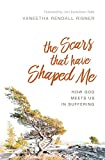 The Scars That Have Shaped Me: How God Meets Us in Suffering