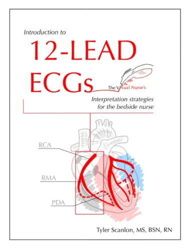 Introduction to 12-Lead ECGs: Interpretation Strategies for The Bedside Nurse