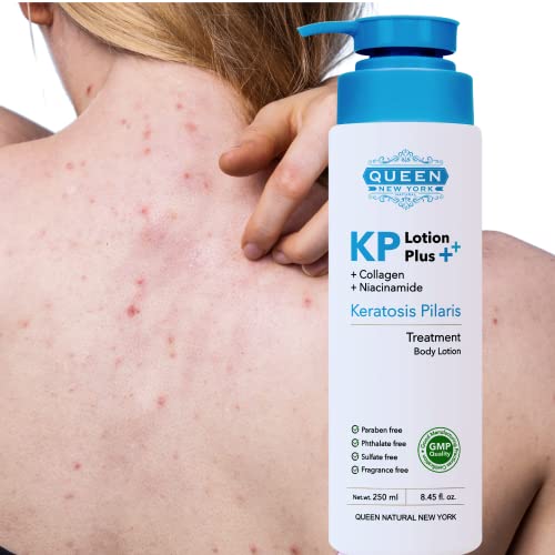 QUEEN KP PLUS Keratosis Pilaris Exfoliating Body Lotion+Collagen Niacinamide|12% Glycolic Acid-2% Salicylic Acid-AHA BHA Gets Rid Of Redness, Fragrance Free(250ml/8.45fl.oz)