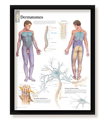 Dermatomes Framed Medical Educational Informational Poster Diagram Doctors Office School Classroom 22x28 Inches