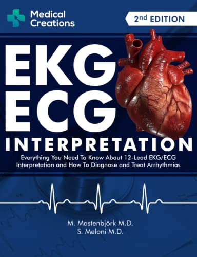 EKG/ECG Interpretation: Everything you Need to Know about the 12 - Lead ECG/EKG Interpretation and How to Diagnose and Treat Arrhythmias