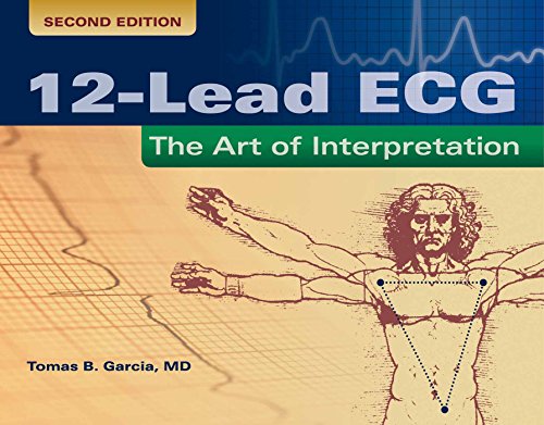 12-Lead ECG: The Art of Interpretation: The Art of Interpretation (Garcia, Introduction to 12-Lead ECG)