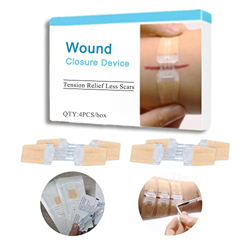 4Pcs Zip Stitch Sutures, Extra Large Steri Strips Wound Closure Device, Waterproof Butterfly Wound Closure Strips, Hospital Grade Laceration Kit