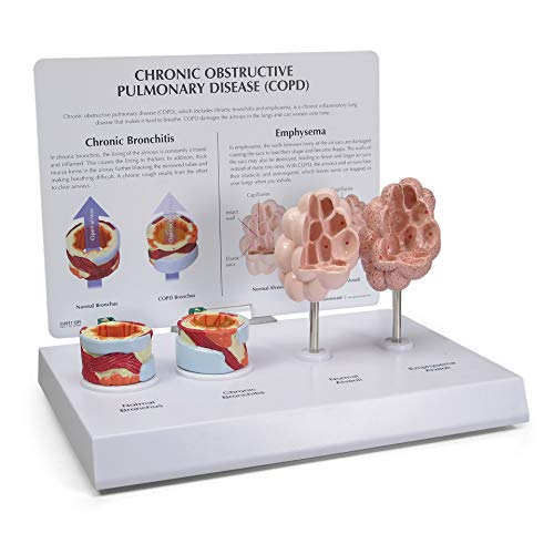 Lung Bronchi Model | Human Body Anatomy Replica of Respiratory System w/Chronic Obstructive Pulmonary Disease (COPD) for Doctors Office Educational Tool | GPI Anatomicals