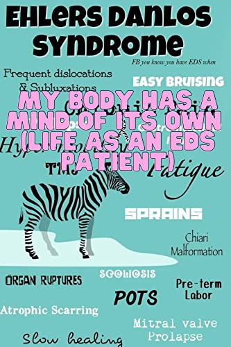 EHLERS- DANLOS SYNROME: MY BODY HAS A MIND OF ITS OWN (LIFE AS AN EDS PATIENT): types, holistic treatments, pain management, gastroenterology, neurology.