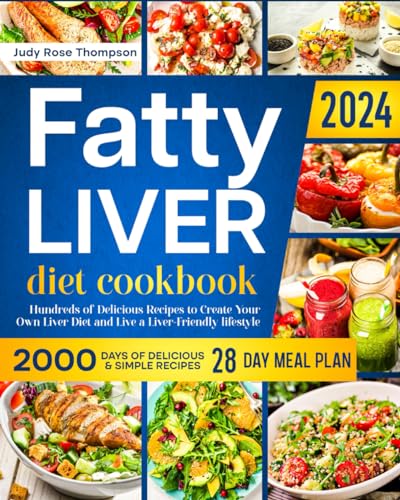 Fatty Liver Diet Cookbook: Hundreds of Delicious Recipes to Create Your Own Liver Diet and Live a Liver-Friendly lifestyle