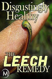 Disgustingly Healthy: The Leech Remedy