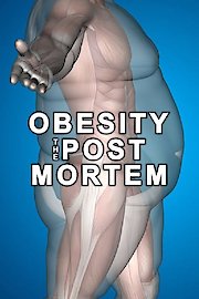 Obesity: The Post Mortem