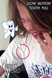 Slow Motion Tooth Pull