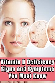 Vitamin D Deficiency - Signs and Symptoms You Must Know