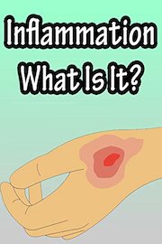 Inflammation, What Is It?