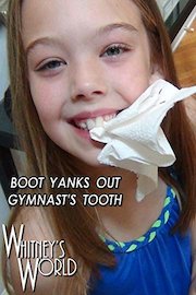 Boot Yanks Out Gymnast's Tooth