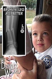 Broken Leg All Better