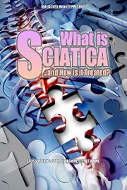 What is Sciatica: and How Is It Treated?