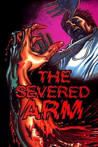 The Severed Arm