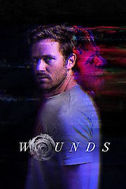 Wounds