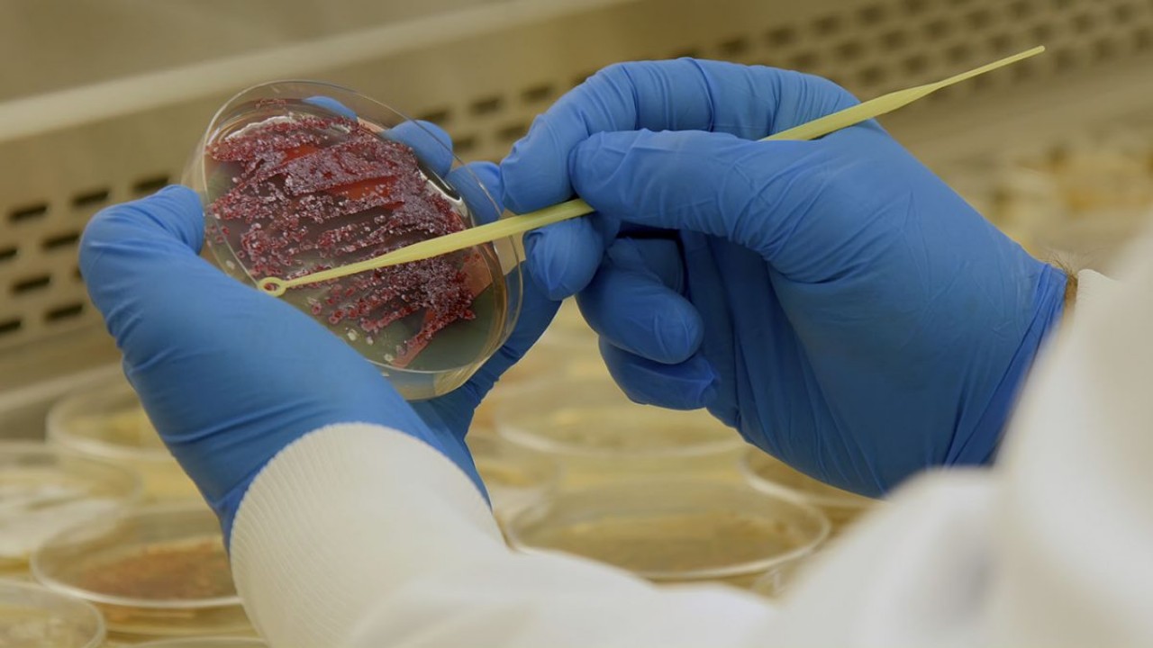 Beating Superbugs: Can We Win?