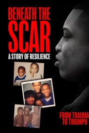 Beneath the Scar: A Story of Resilience