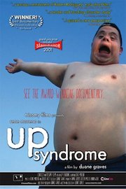 Up Syndrome