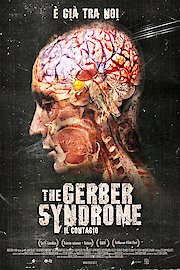 Gerber Syndrome