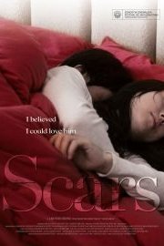Scars