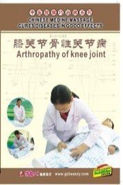 Osteoarthrosis of Knee Joint