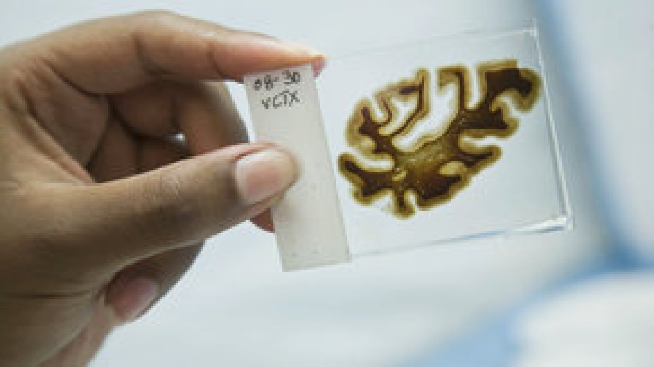 Alzheimer's Project: Momentum in Sci 2