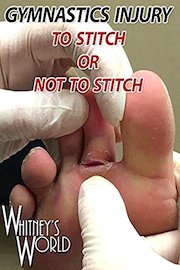Gymnastics Injury - To Stitch or Not To Stitch