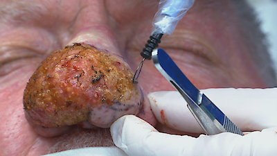 Dr. Pimple Popper: Breaking Out Season 1 Episode 1
