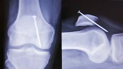 Bizarre ER Season 6 Episode 3