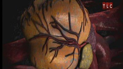 Dr. G: Medical Examiner Season 6 Episode 19