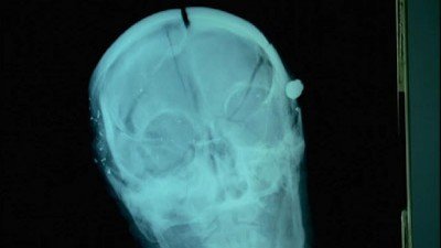 Dr. G: Medical Examiner Season 6 Episode 24