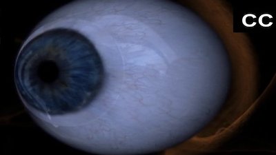 Monsters Inside Me Season 1 Episode 4