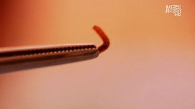 Monsters Inside Me Season 2 Episode 7