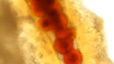 NOVA scienceNOW Season 2 Episode 5