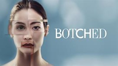 Botched Season 4 Episode 5