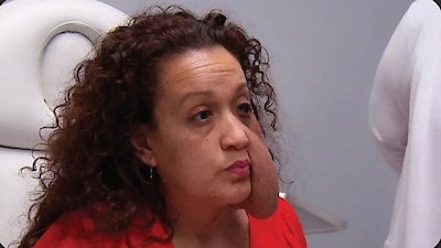 Botched Season 8 Episode 20