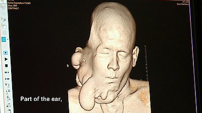 Body Bizarre Season 4 Episode 2